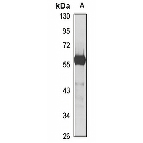 Semenogelin-1 Rabbit Polyclonal Antibody