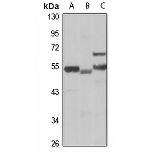 SLA/LP Rabbit Polyclonal Antibody