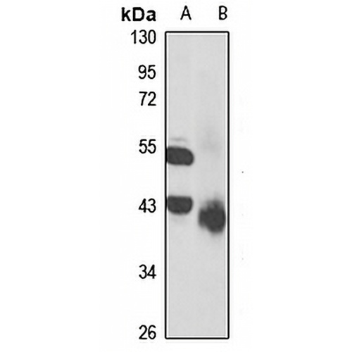 Serpin A7 Rabbit Polyclonal Antibody
