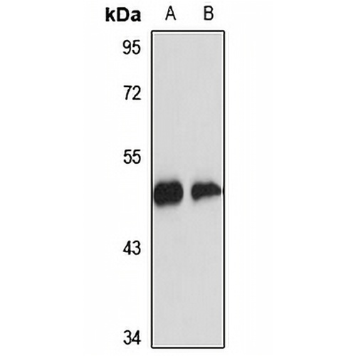 Headpin Rabbit Polyclonal Antibody