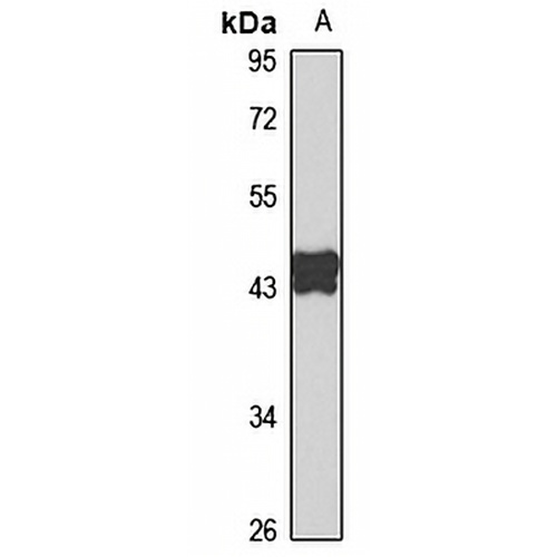 PAI1 Rabbit Polyclonal Antibody