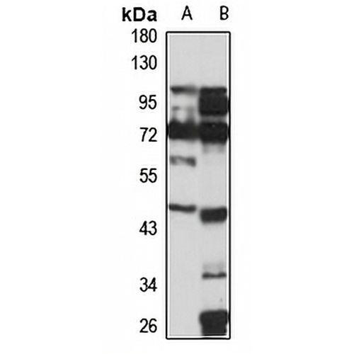 SETD4 Rabbit Polyclonal Antibody