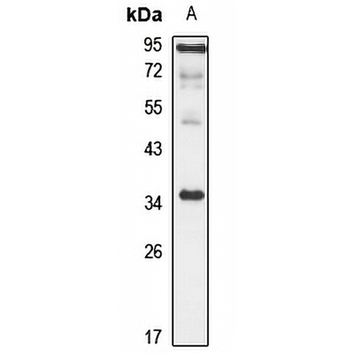 Gamma-sarcoglycan Rabbit Polyclonal Antibody