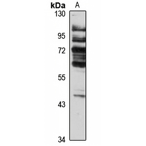 SGK2 Rabbit Polyclonal Antibody