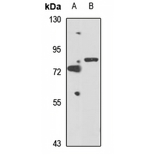 SH3BP2 Rabbit Polyclonal Antibody