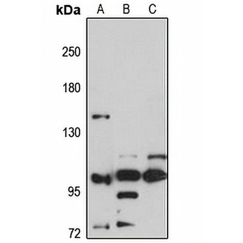 SH3BP4 Rabbit Polyclonal Antibody