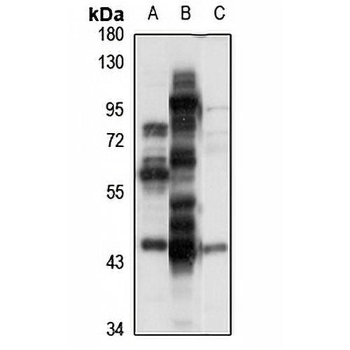 Endophilin-B1 Rabbit Polyclonal Antibody