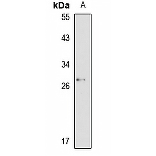 SLA2 Rabbit Polyclonal Antibody
