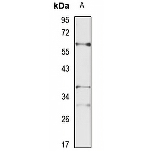 NTCP Rabbit Polyclonal Antibody
