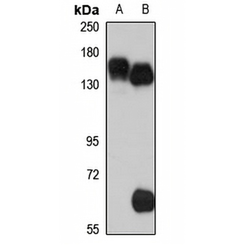 SLC12A1 Rabbit Polyclonal Antibody
