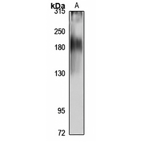 NKCC1 Rabbit Polyclonal Antibody