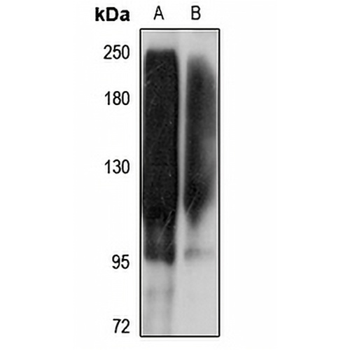SLC12A5 Rabbit Polyclonal Antibody