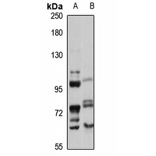 SLC14A2 Rabbit Polyclonal Antibody