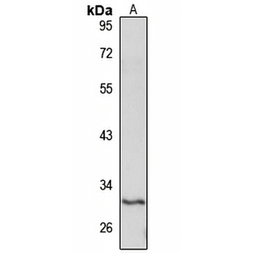 SLC17A5 Rabbit Polyclonal Antibody