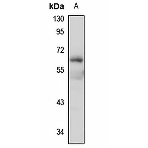 SLC17A7 Rabbit Polyclonal Antibody