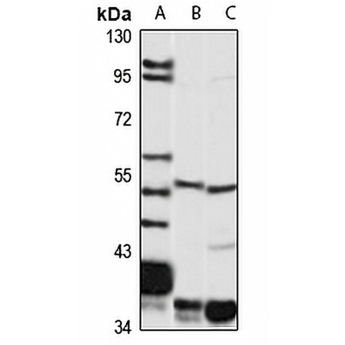 VMAT2 Rabbit Polyclonal Antibody
