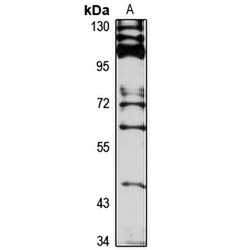 SLC22A15 Rabbit Polyclonal Antibody