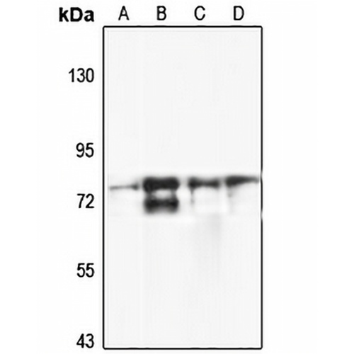SLC22A23 Rabbit Polyclonal Antibody