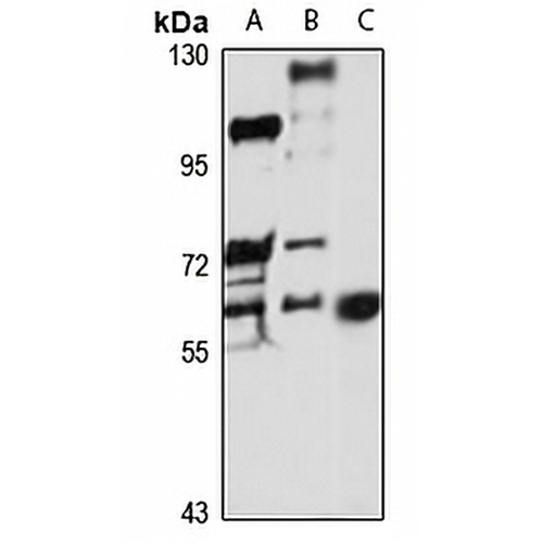 PAHT Rabbit Polyclonal Antibody