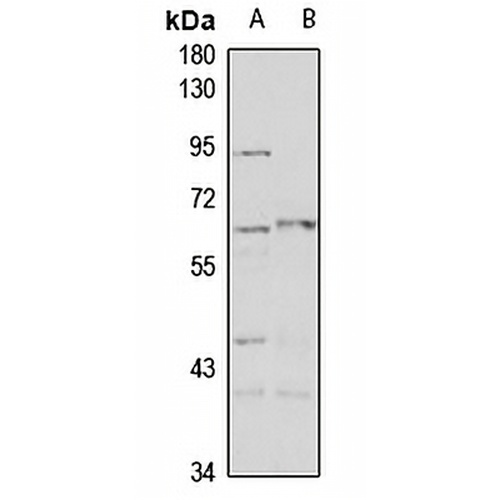 PAHT Rabbit Polyclonal Antibody