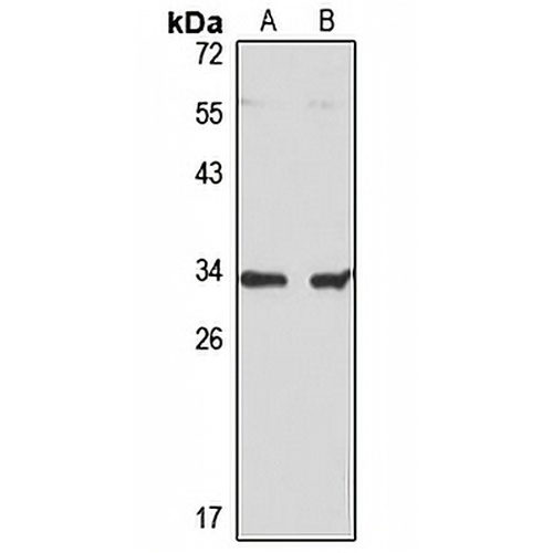 UCP5 Rabbit Polyclonal Antibody