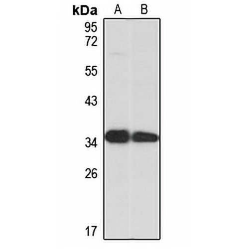 UCP4 Rabbit Polyclonal Antibody