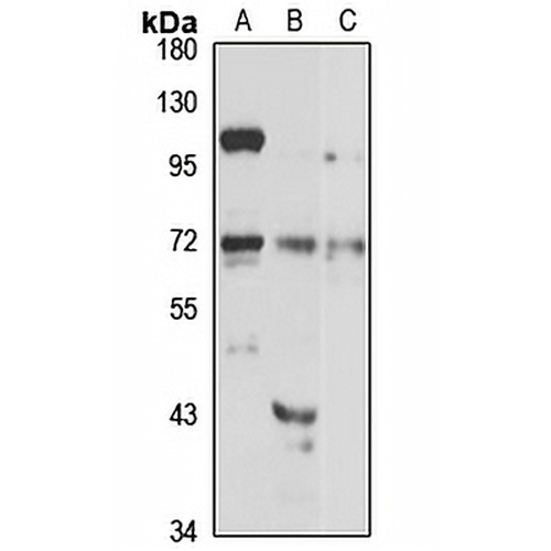 SLC27A1 Rabbit Polyclonal Antibody