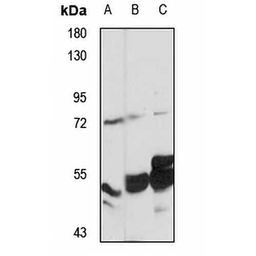 FATP4 Rabbit Polyclonal Antibody