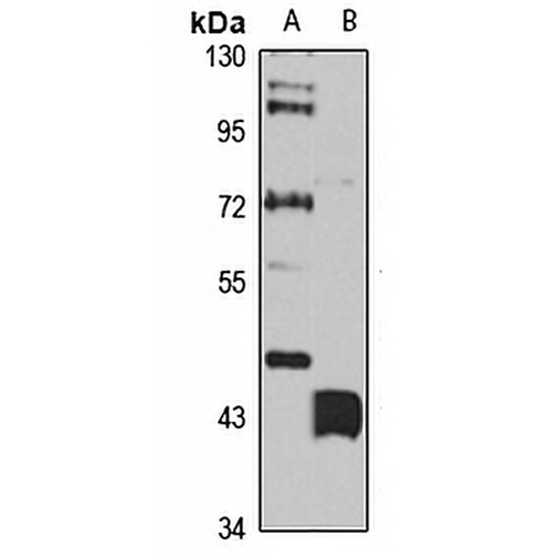 SLC27A6 Rabbit Polyclonal Antibody