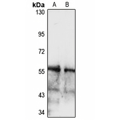 SLC2A9 Rabbit Polyclonal Antibody