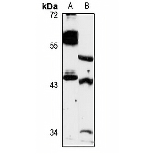 ZNT4 Rabbit Polyclonal Antibody