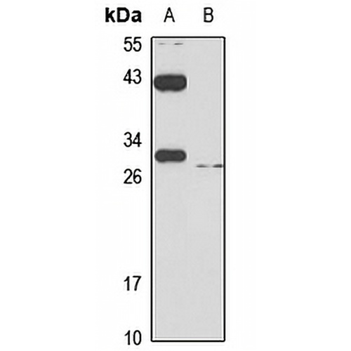 SLC31A1 Rabbit Polyclonal Antibody