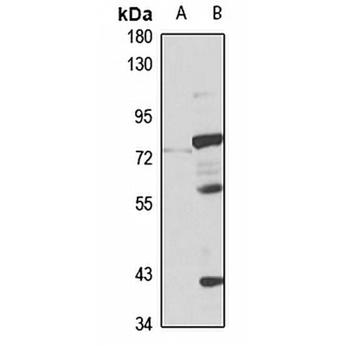 ZIP4 Rabbit Polyclonal Antibody