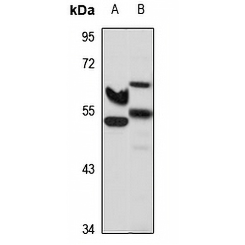 SLC39A8 Rabbit Polyclonal Antibody