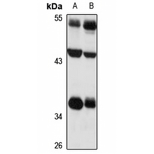 SLC7A11 Rabbit Polyclonal Antibody