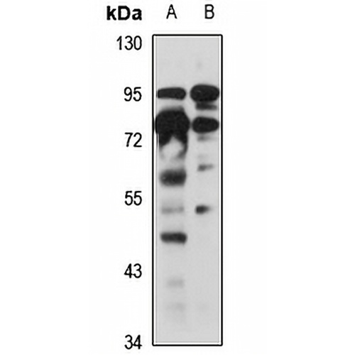 SLITRK4 Rabbit Polyclonal Antibody