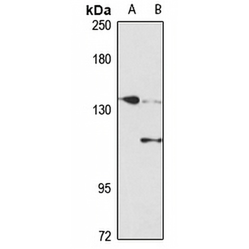 SMC2 Rabbit Polyclonal Antibody