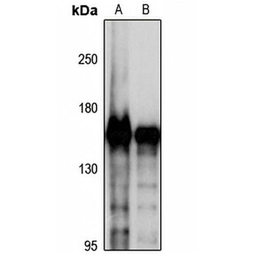 SMC4 Rabbit Polyclonal Antibody