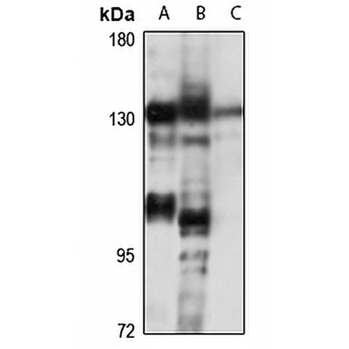 SMC5 Rabbit Polyclonal Antibody