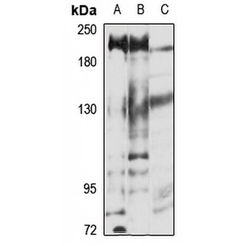 SMG6 Rabbit Polyclonal Antibody