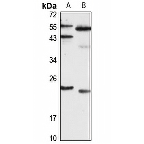 SNAP23 Rabbit Polyclonal Antibody