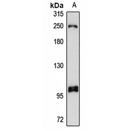 HELIC2 Rabbit Polyclonal Antibody