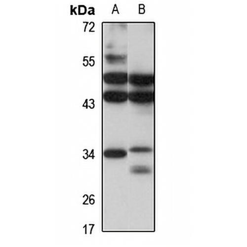 SNRNP35 Rabbit Polyclonal Antibody