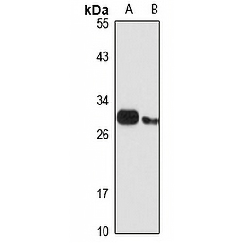 SNRPB Rabbit Polyclonal Antibody
