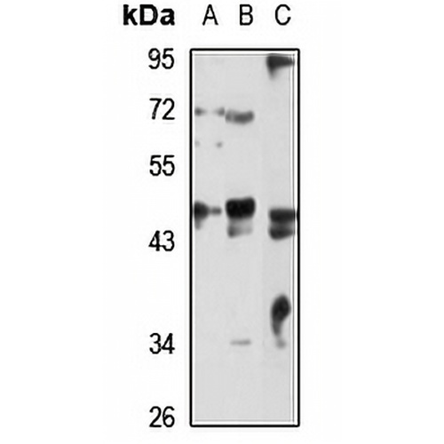 SNX6 Rabbit Polyclonal Antibody