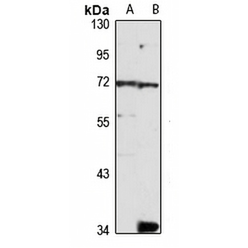 SOCS5 Rabbit Polyclonal Antibody
