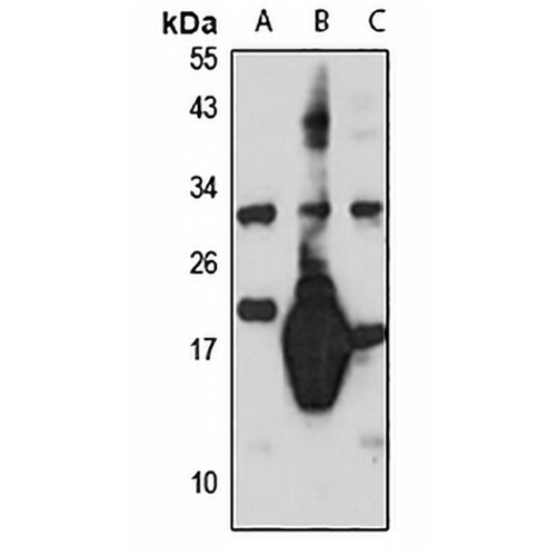Sp17 Rabbit Polyclonal Antibody