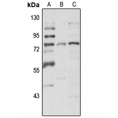 SPATA7 Rabbit Polyclonal Antibody