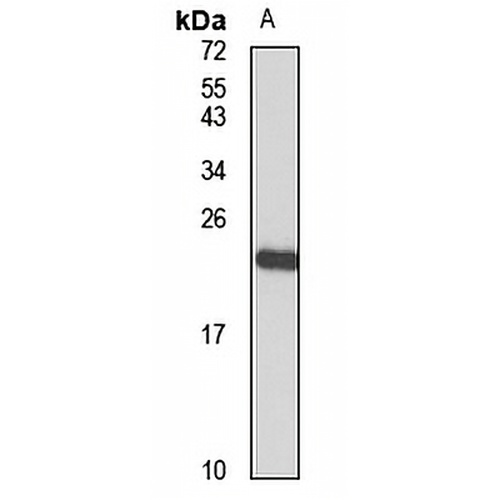 SPC24 Rabbit Polyclonal Antibody