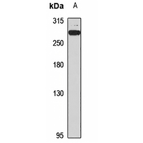 Spatacsin Rabbit Polyclonal Antibody